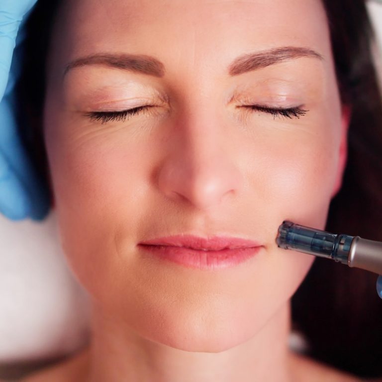 SkinPen in Derby, KS